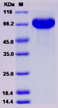 Recombinant Human A1BG / alpha 1B-Glycoprotein Protein (His Tag)