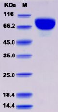 Recombinant Human Biotinidase / Biotinase / BTD Protein (His tag)