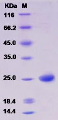 Recombinant Human BMF / Bcl2 modifying factor Protein (His tag)