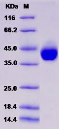 Recombinant Human Alpha-2-glycoprotein / AZGP1 Protein (His tag)