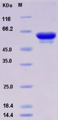 Recombinant Human ALDOB / Aldolase B Protein GST tag