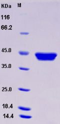 Recombinant Human RRM2B / P53R2 Protein (His tag)