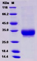Recombinant Human AMBP / Alpha 1 microglobulin Protein (His tag)