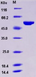 Recombinant Human ALDH3A1 Protein (His tag)