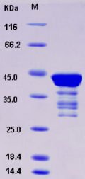 Recombinant Human C1D Protein (GST tag)