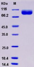 Recombinant Human BCHE / Butyrylcholinesterase Protein (His tag)