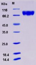 Recombinant Human c-KIT / CD117 Protein (His tag)