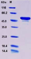 Recombinant Human ANP32A / PHAP1 Protein (His & GST tag)