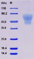 Recombinant Human C4.4A / LYPD3 Protein (His tag)