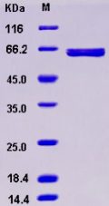 Recombinant Human AIM2 Protein (GST tag)