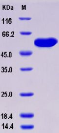 Recombinant Human ALDH7A1 / ATQ1 Protein (His tag)