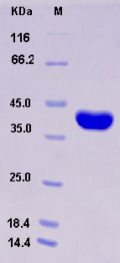 Recombinant Human AKR1A1 Protein (His tag)