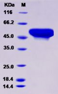 Recombinant Human ADSL / Adenylosuccinate Lyase Protein (His tag)