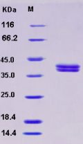 Recombinant Human CADM3 / NECL1 / IGSF4B Protein (His tag)