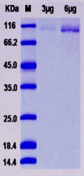 Recombinant Human AGO2 / Argonaute 2 / EIF2C2 Protein (His tag)
