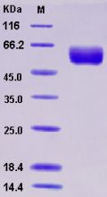 Recombinant Human Angiotensinogen / SerpinA8 / AGT Protein (His tag)