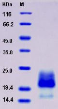 Recombinant Human BAMBI / NMA Protein (His tag)