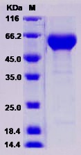 Recombinant Human Osteomodulin / OMD Protein (His Tag)