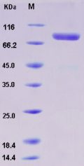 Recombinant Human c-MET / HGFR Protein (His tag)