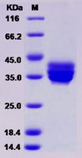 Recombinant Human TNFRSF17 / BCMA / CD269 Protein (Fc Tag)