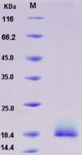 Recombinant Human ALK4 / ACVR1B Protein (His tag)