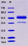 Recombinant Human ALK4 / ACVR1B Protein (His & Fc tag)