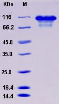 Recombinant Human KNG1 / BDK / Kininogen-1 Protein (His tag)
