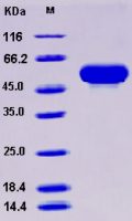 Recombinant Human CD131 / CSF2RB / IL3RB / IL5RB Protein (His tag)