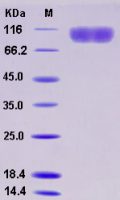Recombinant Human CD140b / PDGFRB Protein (His tag)