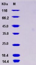 Recombinant Human TREM1 Protein (His tag)