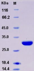 Recombinant Human Carbonic Anhydrase II / CA2 Protein (His tag)