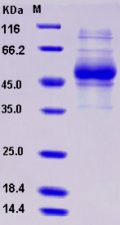 Recombinant Human IL5Ra / CD125 Protein (His tag)
