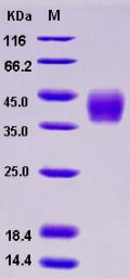 Recombinant Human B7-DC / PD-L2 / CD273 Protein (His tag)