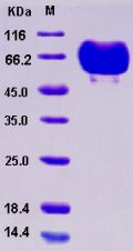 Recombinant Human B7-DC / PD-L2 / CD273 Protein (His & Fc tag)