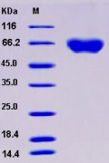 Recombinant Human Axl Kinase Protein (His tag)