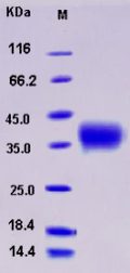 Recombinant Human ACVR2 / ACTRII / ACVR2A Protein (His tag)