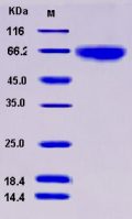 Recombinant Human MMP-8 / CLG1 Protein