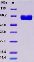 Recombinant Human ACVR2B / ActivinR-IIB Protein (Fc tag)