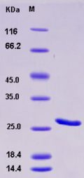 Recombinant Human BCL2 / Bcl-2 Protein (His tag)