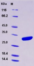 Recombinant Human Adipsin / Complement Factor D / CFD Protein (His tag)