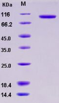 Recombinant Human Cadherin-6 / CDH6 Protein (His tag)