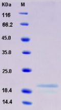 Recombinant Human AgRP / AGRP Protein (His tag)