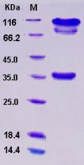 Recombinant Human BACE1 / ASP2 Protein (Fc tag)