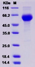 Recombinant Mouse PLA2G7 / PAFAH Protein (His Tag)
