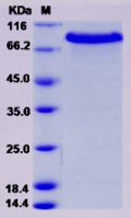 Recombinant Mouse CRELD1 Protein (ECD, Fc Tag)