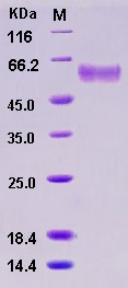 Recombinant Mouse sFRP4 Protein (His tag)