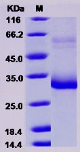 Recombinant Mouse MBL-2 / MBL Protein (His Tag)