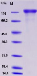 Recombinant Rat VEGFR2 / Flk-1 / CD309 / KDR Protein (His tag)
