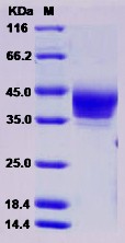 Recombinant Rat B7-H6 / B7H6 / NCR3LG1 Protein (His Tag)