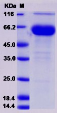 Recombinant Rat FOLR1 / Folate Receptor 1 Protein (Fc tag)